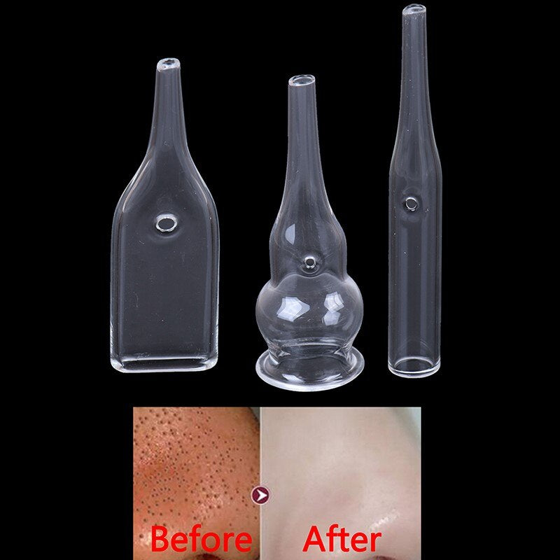 after using Blackhead Removal Glass Pipes