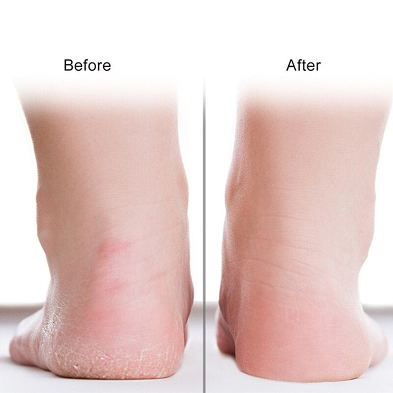 Before and after feet