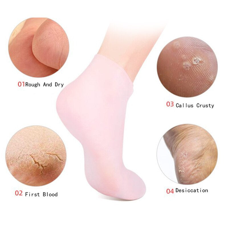 feet skin issue