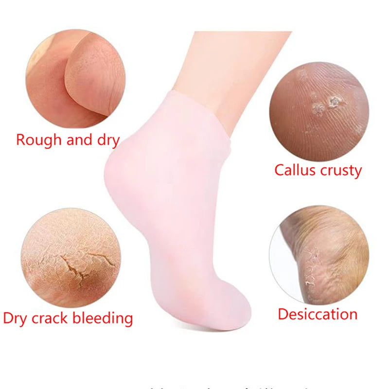 Pamper Your Feet with Our Silicone Moisturizing Gel Heel Socks