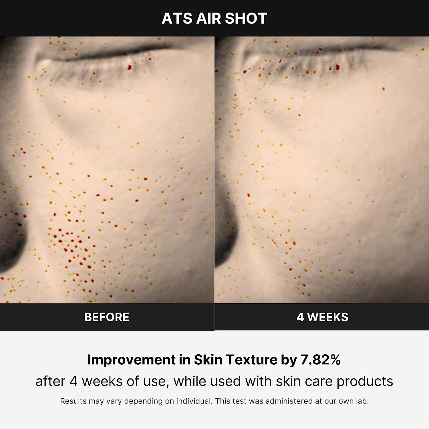 Age-R ATS Air Shot After 4 Weeks