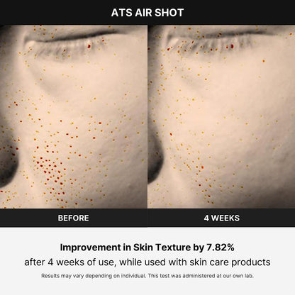 Age-R ATS Air Shot After 4 Weeks