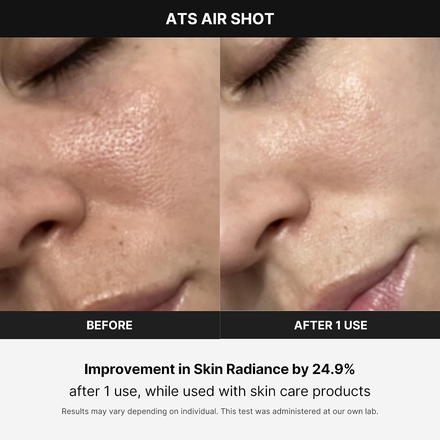 Face Age-R ATS Air Shot Before and After